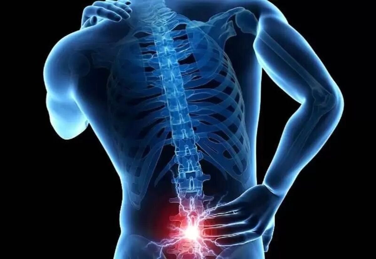 شایعترین علائم دیسک کمر و راههای تشخیص آن (ویدئو)