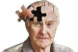 ۴ نشانهای که میتواند پیشرفت بیماری آلزایمر را پیشبینی کند